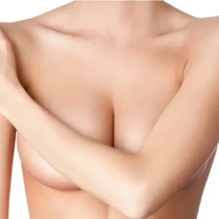 Augmentation mammaire Tunisie - Les suites opératoires d'une augmentation mammaire Tunisie